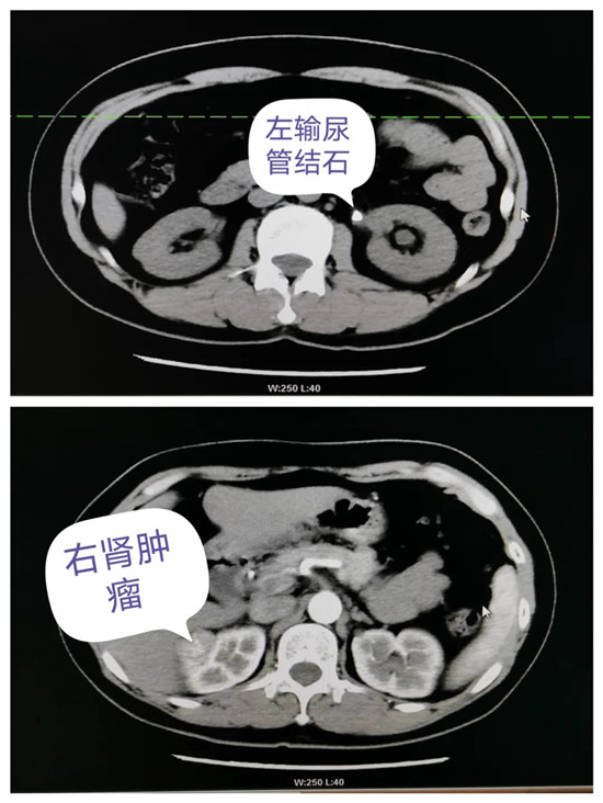 https://www.hnjkw.com/upload/localpc/xinwen/202008051003067202199.jpg